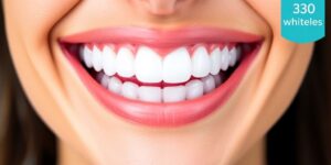 Strahlend weiße Zähne nach der Zahnaufhellung.